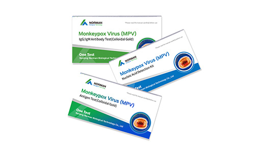 मंकीपॉक्स वायरस एंटीबॉडी टेस्ट किट के लिए स्पेन में अधिसूचना

